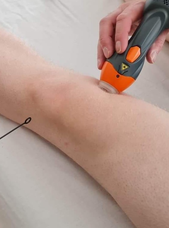 Laserbehandling knæ